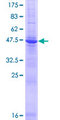 TMED3 Protein - 12.5% SDS-PAGE of human TMED3 stained with Coomassie Blue