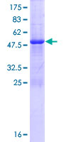 TMED5 Protein - 12.5% SDS-PAGE of human TMED5 stained with Coomassie Blue