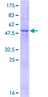 TMED6 Protein - 12.5% SDS-PAGE of human TMED6 stained with Coomassie Blue