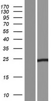 TMED7 Protein - Western validation with an anti-DDK antibody * L: Control HEK293 lysate R: Over-expression lysate