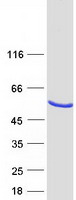TMED8 Protein - Purified recombinant protein TMED8 was analyzed by SDS-PAGE gel and Coomassie Blue Staining