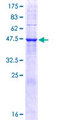 TMED9 Protein - 12.5% SDS-PAGE of human TMED9 stained with Coomassie Blue