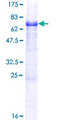 TMEFF1 / Tomoregulin 1 Protein - 12.5% SDS-PAGE of human TMEFF1 stained with Coomassie Blue
