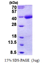 TMEFF1 / Tomoregulin 1 Protein