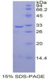 TMEFF1 / Tomoregulin 1 Protein - Recombinant Tomoregulin 1 By SDS-PAGE