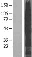 TMEFF2 Protein - Western validation with an anti-DDK antibody * L: Control HEK293 lysate R: Over-expression lysate