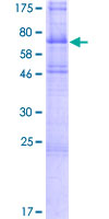 TMEFF2 Protein - 12.5% SDS-PAGE of human TMEFF2 stained with Coomassie Blue