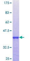 TMEFF2 Protein - 12.5% SDS-PAGE Stained with Coomassie Blue.