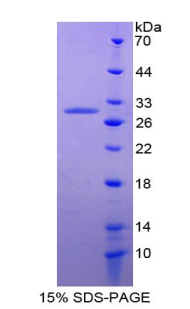 TMEFF2 Protein - Recombinant Tomoregulin By SDS-PAGE