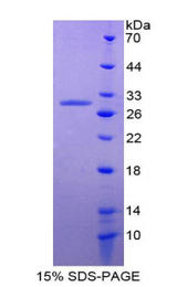 TMEFF2 Protein - Recombinant Tomoregulin By SDS-PAGE