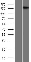 TMEM1 / TRAPPC10 Protein - Western validation with an anti-DDK antibody * L: Control HEK293 lysate R: Over-expression lysate