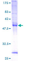 TMEM101 Protein - 12.5% SDS-PAGE of human MGC4251 stained with Coomassie Blue
