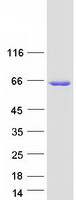TMEM102 Protein - Purified recombinant protein TMEM102 was analyzed by SDS-PAGE gel and Coomassie Blue Staining