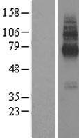 TMEM104 Protein - Western validation with an anti-DDK antibody * L: Control HEK293 lysate R: Over-expression lysate