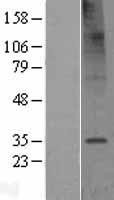 TMEM106C Protein - Western validation with an anti-DDK antibody * L: Control HEK293 lysate R: Over-expression lysate