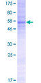 TMEM110 Protein - 12.5% SDS-PAGE of human TMEM110 stained with Coomassie Blue