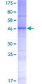 TMEM116 Protein - 12.5% SDS-PAGE of human TMEM116 stained with Coomassie Blue