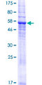 TMEM120A Protein - 12.5% SDS-PAGE of human TMEM120A stained with Coomassie Blue