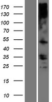 TMEM121 Protein - Western validation with an anti-DDK antibody * L: Control HEK293 lysate R: Over-expression lysate