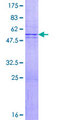 TMEM123 / Porimin Protein - 12.5% SDS-PAGE of human TMEM123 stained with Coomassie Blue