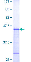 TMEM123 / Porimin Protein - 12.5% SDS-PAGE Stained with Coomassie Blue.
