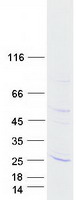 TMEM126A Protein - Purified recombinant protein TMEM126A was analyzed by SDS-PAGE gel and Coomassie Blue Staining