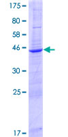 TMEM126B Protein - 12.5% SDS-PAGE of human TMEM126B stained with Coomassie Blue