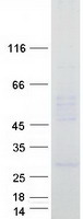 TMEM128 Protein - Purified recombinant protein TMEM128 was analyzed by SDS-PAGE gel and Coomassie Blue Staining