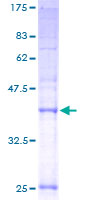 TMEM138 / HSPC196 Protein - 12.5% SDS-PAGE of human HSPC196 stained with Coomassie Blue