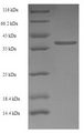 TMEM141 Protein - (Tris-Glycine gel) Discontinuous SDS-PAGE (reduced) with 5% enrichment gel and 15% separation gel.