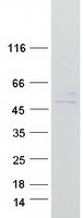 TMEM143 Protein - Purified recombinant protein TMEM143 was analyzed by SDS-PAGE gel and Coomassie Blue Staining