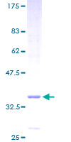 TMEM14A Protein - 12.5% SDS-PAGE of human TMEM14A stained with Coomassie Blue