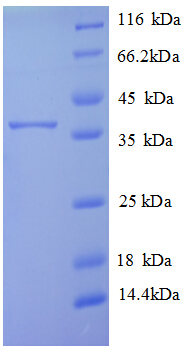 TMEM14B Protein