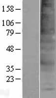 TMEM150A Protein - Western validation with an anti-DDK antibody * L: Control HEK293 lysate R: Over-expression lysate