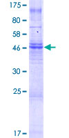 TMEM150A Protein - 12.5% SDS-PAGE of human TMEM150 stained with Coomassie Blue