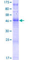 TMEM150A Protein - 12.5% SDS-PAGE of human TMEM150 stained with Coomassie Blue