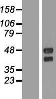TMEM151A Protein - Western validation with an anti-DDK antibody * L: Control HEK293 lysate R: Over-expression lysate