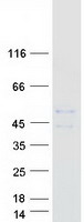 TMEM151A Protein - Purified recombinant protein TMEM151A was analyzed by SDS-PAGE gel and Coomassie Blue Staining