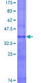 TMEM159 Protein - 12.5% SDS-PAGE of human LOC57146 stained with Coomassie Blue