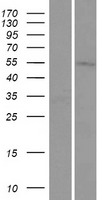 TMEM161A Protein - Western validation with an anti-DDK antibody * L: Control HEK293 lysate R: Over-expression lysate
