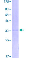 TMEM167B Protein - 12.5% SDS-PAGE of human TMEM167B stained with Coomassie Blue