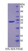 TMEM16B / ANO2 Protein - Recombinant Anoctamin 2 (ANO2) by SDS-PAGE