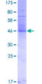 TMEM17 Protein - 12.5% SDS-PAGE of human TMEM17 stained with Coomassie Blue