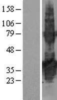 TMEM171 Protein - Western validation with an anti-DDK antibody * L: Control HEK293 lysate R: Over-expression lysate