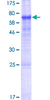 TMEM171 Protein - 12.5% SDS-PAGE of human TMEM171 stained with Coomassie Blue