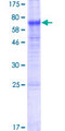 TMEM171 Protein - 12.5% SDS-PAGE of human TMEM171 stained with Coomassie Blue