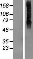 TMEM175 / MGC4618 Protein - Western validation with an anti-DDK antibody * L: Control HEK293 lysate R: Over-expression lysate