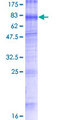 TMEM175 / MGC4618 Protein - 12.5% SDS-PAGE of human TMEM175 stained with Coomassie Blue