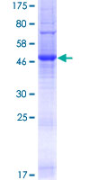 TMEM176A / HCA112 Protein - 12.5% SDS-PAGE of human TMEM176A stained with Coomassie Blue