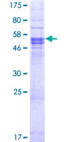 TMEM176B / LR8 Protein - 12.5% SDS-PAGE of human TMEM176B stained with Coomassie Blue